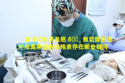 金 🐶 承龙疤 🌸 痕切除后图片与美莱祛疤价格表存在哪些疑问之处